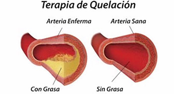 quela002